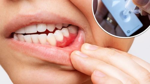 Researchers invent a 10-minute test to spot gum disease - and it could slash risk of heart attacks and strokes